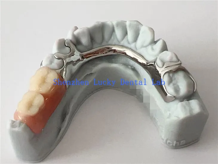 Drukuj 3D Chiny Dostosowane ramy dentystyczne z protezą akrylową