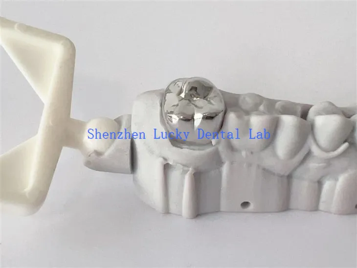 Full Metal Crown z printem 3D Dental COCR COCR