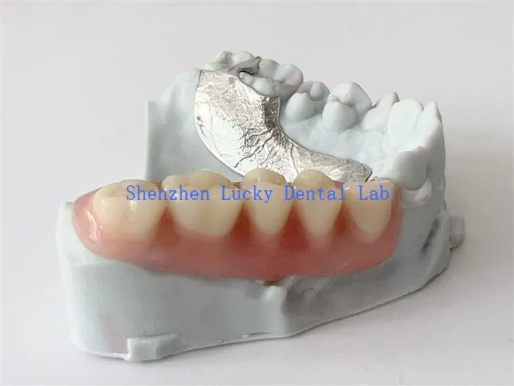 Framework z metalami dentystycznymi 3D z przezroczystym zapięciem