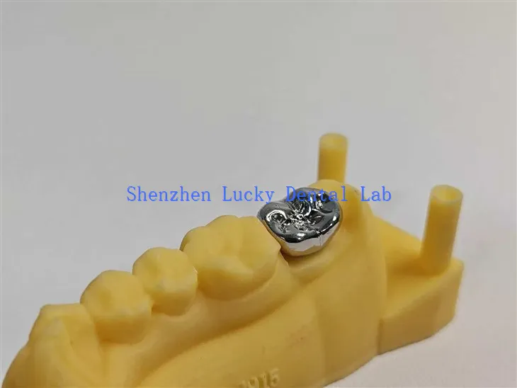 Drukuj 3D Wysokiej jakości stomatowa fmc pełna metalowa korona