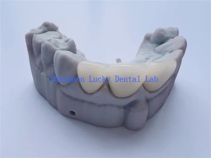Laboratorium dentystyczne forniny 3D Porcela