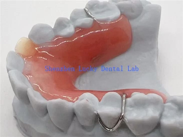 Zdejmowana proteza częściowa do druku 3D z podstawą akrylową