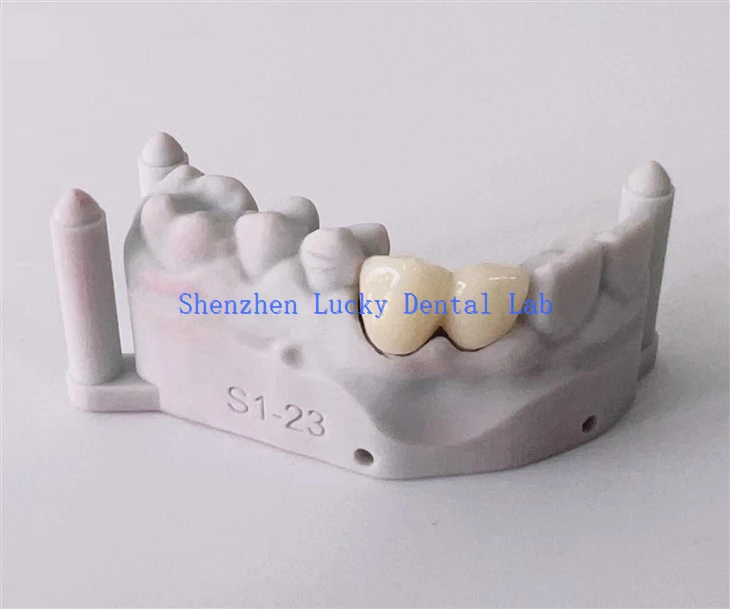 Estetyczny nadruk 3D dentysty