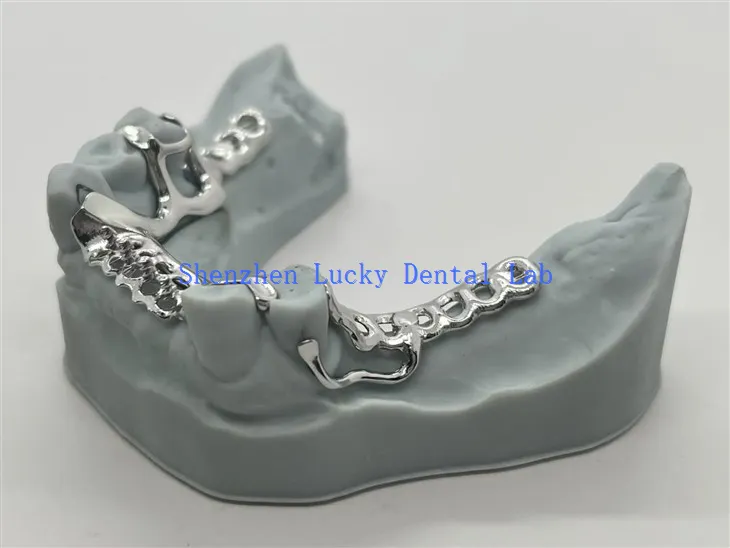 Niedrogi metal dentystyczny