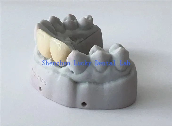 China 3D Print Dental PFM COCR Crown