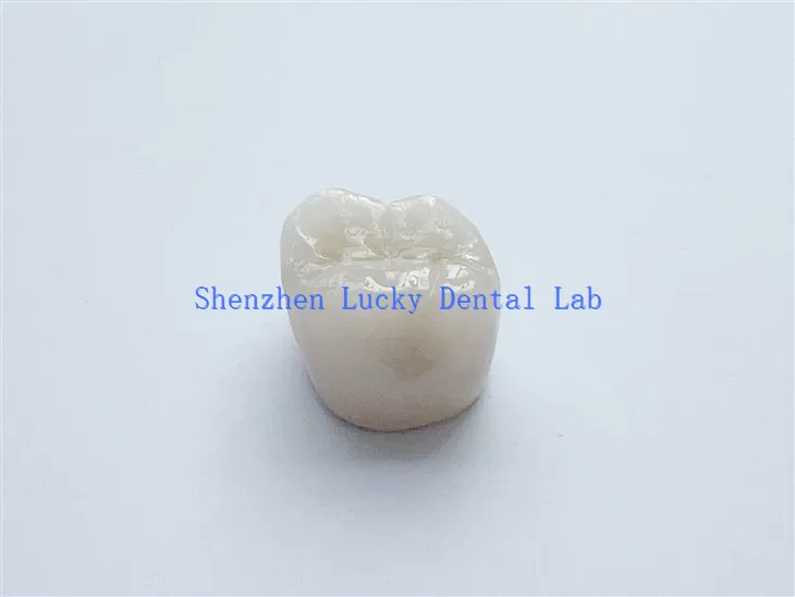 China Dental PFM COCR Crown Bez metalowego marginesu