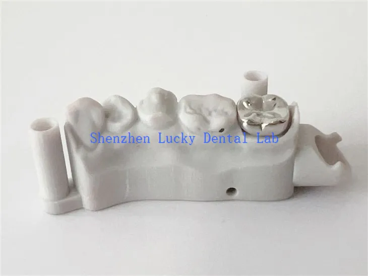 Chiny Wysokiej jakości wydruku 3D Dental Full Metal Crown