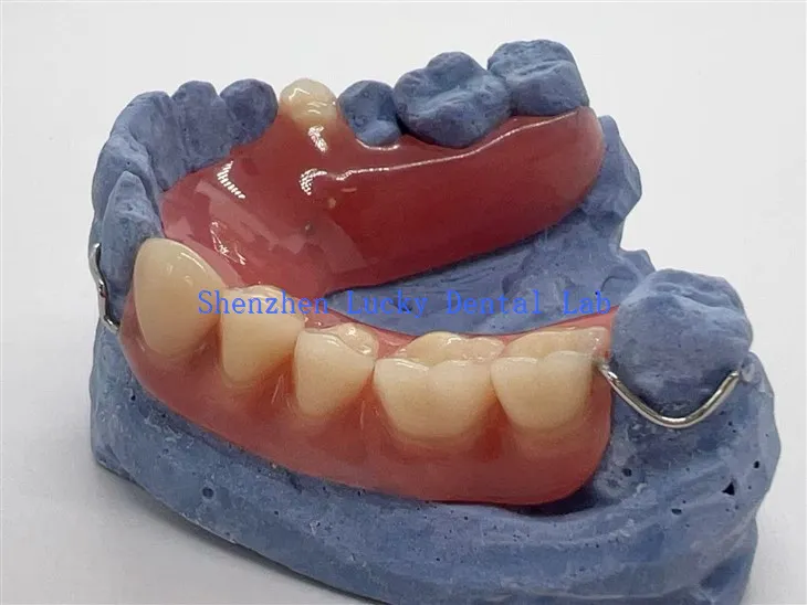 Wygodna częściowa proteza akrylowa z drutem