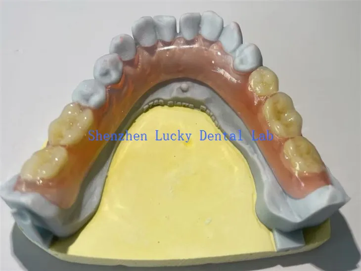 Wygodne częściowe elastyczne producenci protezy dentystycznej