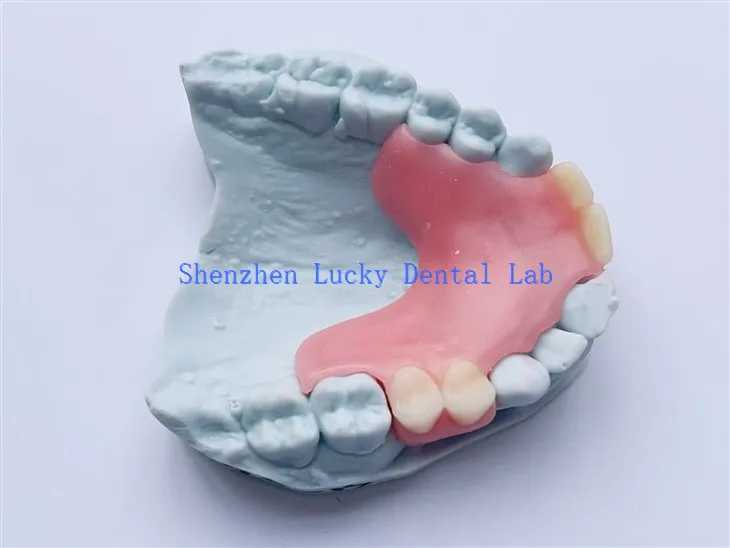 Spersonalizowana częściowa próba z dentystycznym próby u producentów