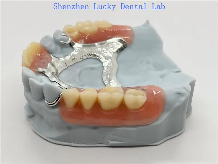 Metalowa konstrukcja w kształcie podkowy-dentystycznej