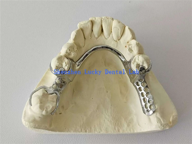 Dental Metal Framework/ Metal Base