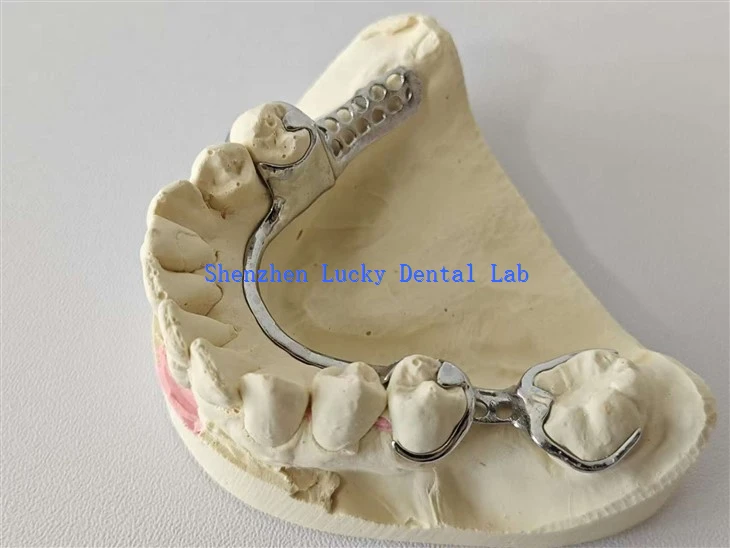 Dentystyczna rama metalowa/ baza metalowa
