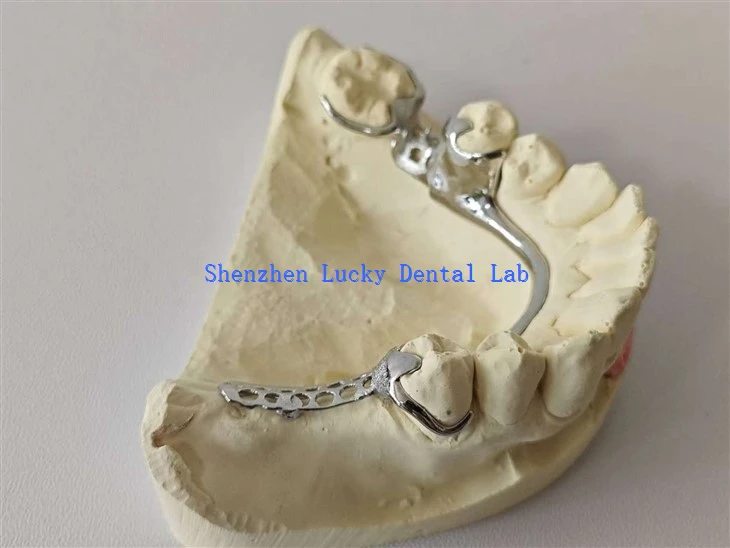Dental Metal Framework/ Metal Base