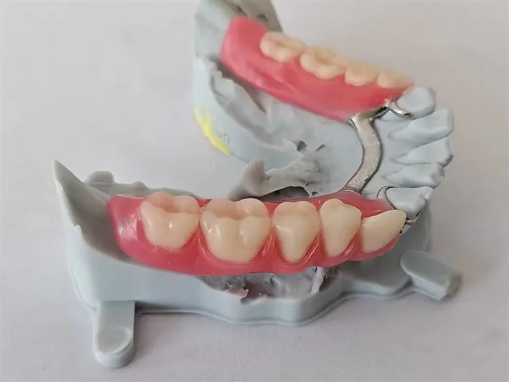 Częściowa proteza zębowa z metalową ramą/podstawą spróbuj
