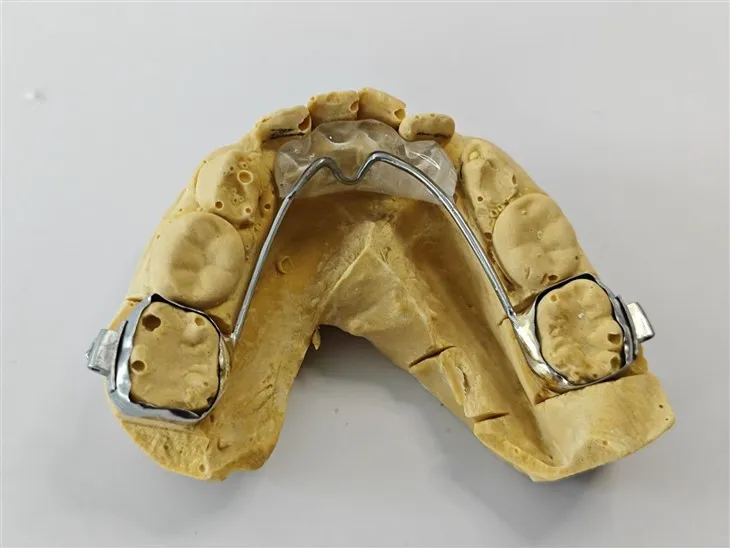 Dentystyczna przednia płaszczyzna ugryzienia