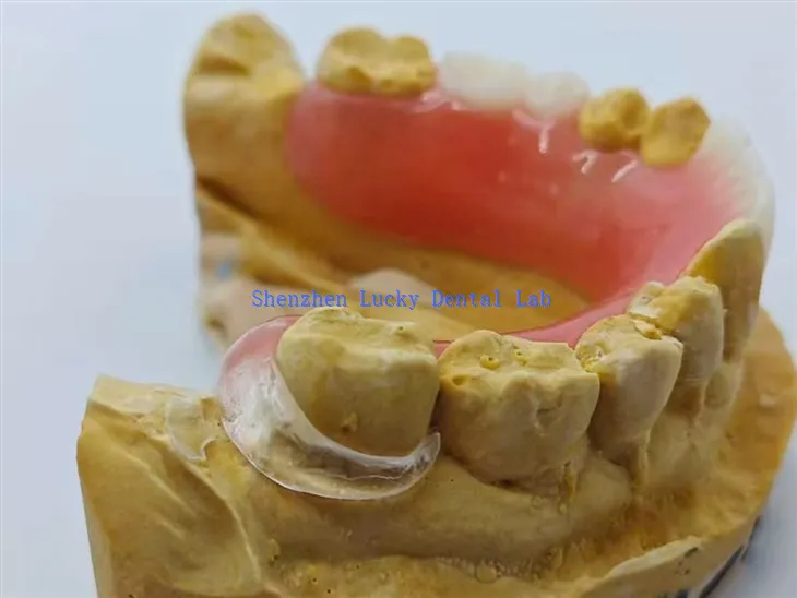 Protea akrylowa z przezroczystym zapięciem