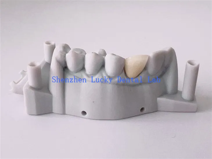Doskonały nadruk 3D Dental PFM COCR Crown