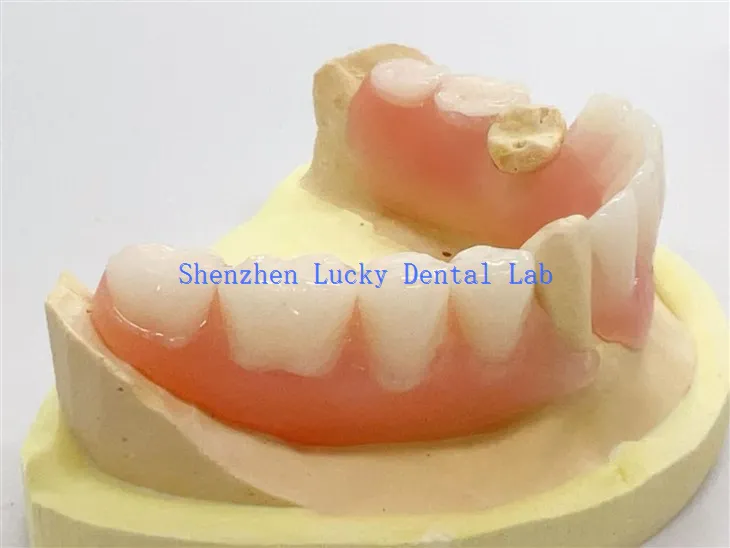 Wysokiej jakości częściowy elastyczna proteon