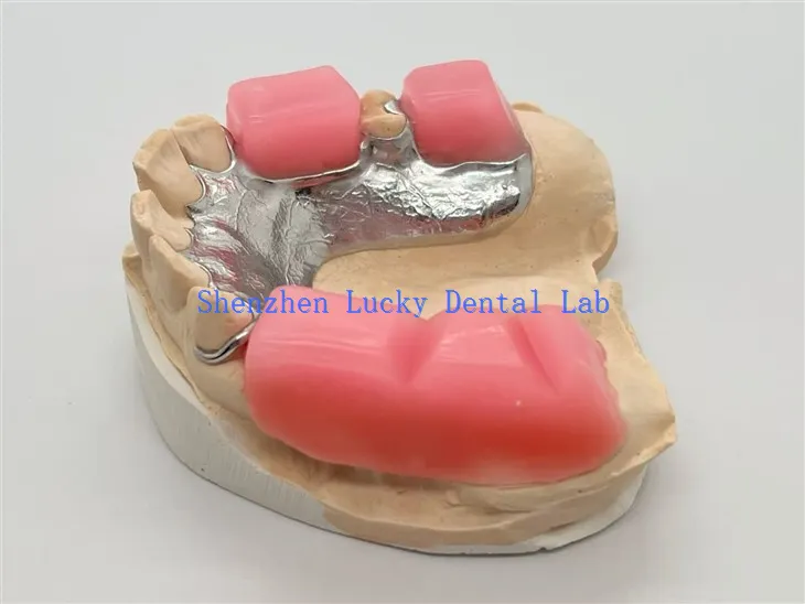 Metalowa rama z blokadą zgryzu