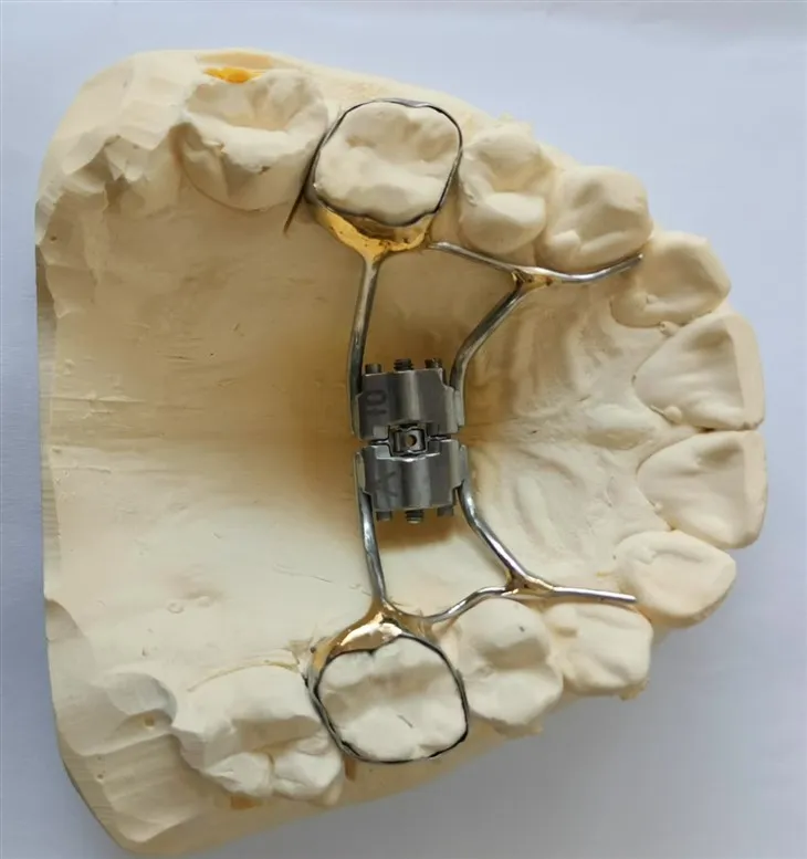 Palatalny Expander wyprodukowany w Chinach