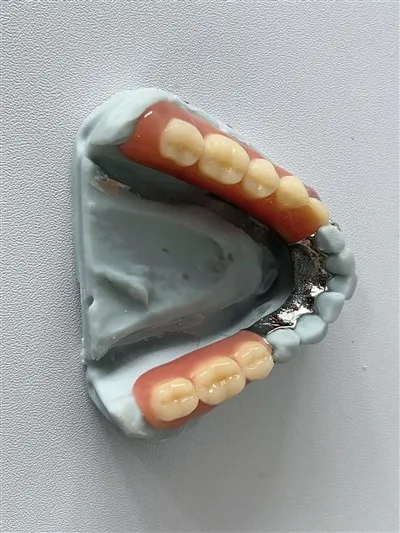 Wysokiej jakości framework metalowy dentystyczny 3D z producentami płyt językowych