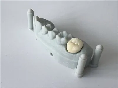 Naturalne dentystyczne całą porcelanową cyrkonię wyprodukowaną w Chinach