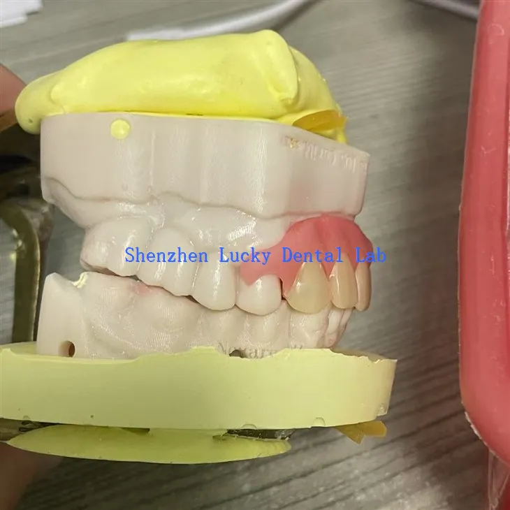 Wygodna częściowa elastyczna prasa próba w laboratorium dentystycznym