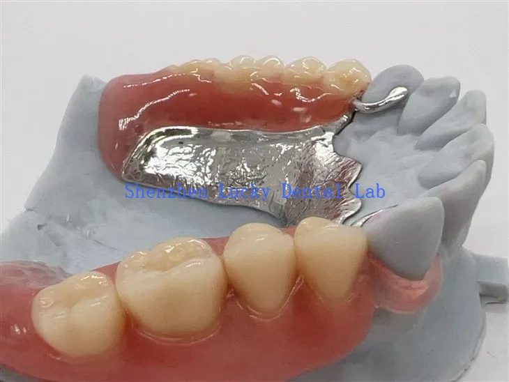 Framework z protezy akrylowej z protezy akrylowej