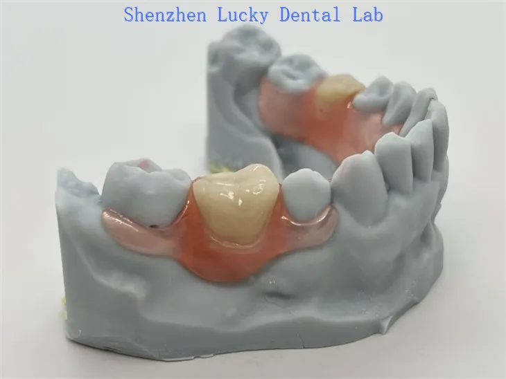 CZĘŚĆ SZCZĘŚLIWY VALPLAST® z elastycznym zapięciem